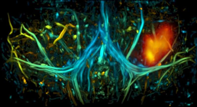 Mapping the 4T1 breast tumor (shown in yellow-red) with its blood vessels (shown in blue-green) by integrated photoacoustic and ultrasound tomography on a Blvra-/- mouse. Credit: Junjie Yao and Vladislav V. Verkhusha Light-sensitive molecule allows researchers to visualize and manipulate cells in deep tissues